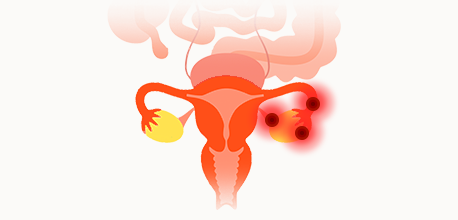 3기
